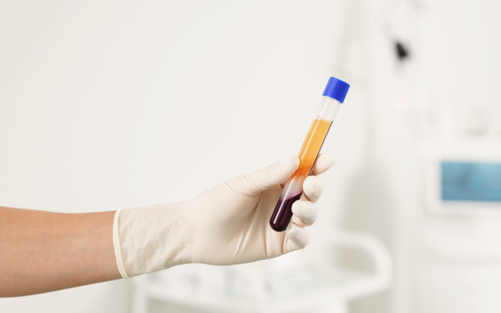 PRP Injections Matthewson Orthopedics plasma